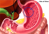 Dr. Patta Radhakrishna-Gastroenterology specialist